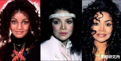Celebrity_Plastic_Surgery_06.jpg