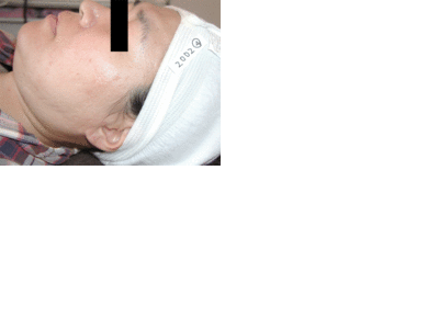 aftertm_convert_20130322153105.gif